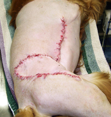 Soft tissue sarcoma post-op