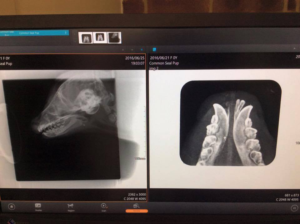 Seal x-ray