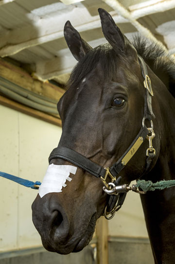 Nasal Strip