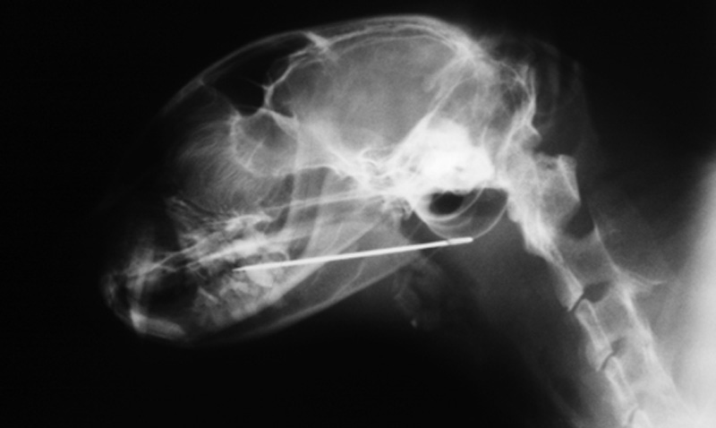 Cat who swallowed sewing needle