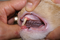 Teeth removal