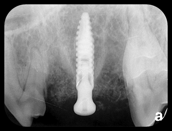 Canine dental implant