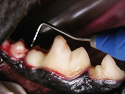 Deep periodontal pocket
