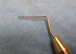 Dental probe