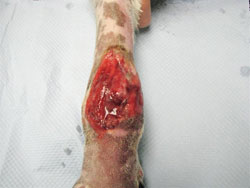 CS Wound