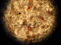 demodex injai