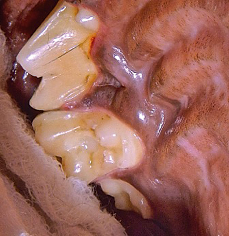 A caries restoration of the right maxillary first molar tooth (tooth 109) of the same dog in Figure 1. A light-cured composite filling material was used to fill the cavity preparation.