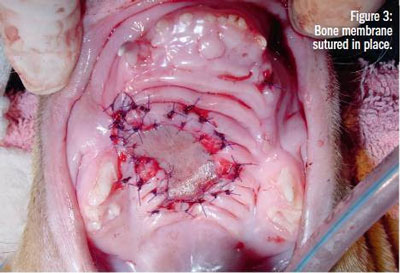 Figure 3: Bone membrane sutured in place.