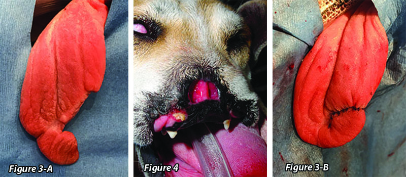 maxillofacial trauma