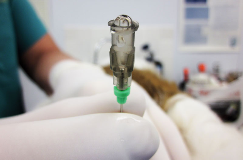 The 2015 AAHA/AAFP Pain Management Guidelines say that an epidural "should be strongly considered."