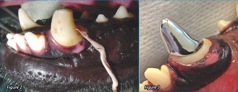 Figure 2, 3: Fractured and fixed tooth 304