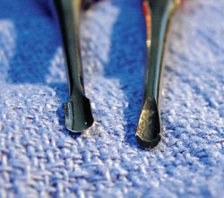Shedding Light On Surgical Exodontics