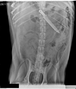 Stop Procrastinating! Radiograph Contest Entries Due June 30
