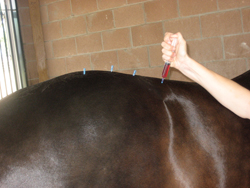 Acupuncture, Chiropractic offer more Options