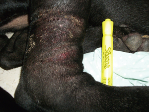 Case Study: Laser Therapy Helps Avert Amputation