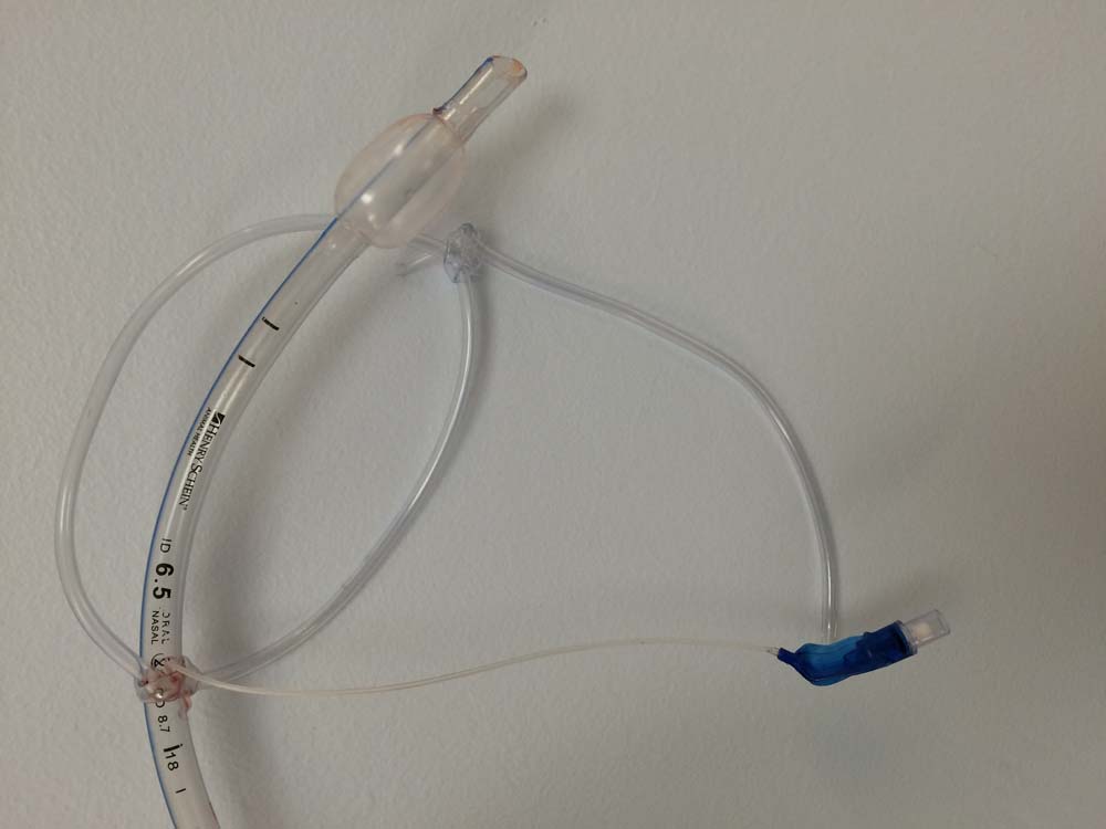 The Curious Case of the Inflated Endotracheal Tube