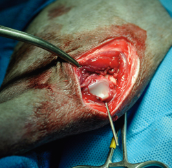 One Pro’s Take On Orthopedic Advances