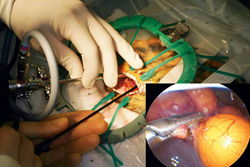Exotics Endoscopy Sets Care Standard