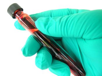 Blood Analyzers: How Old Is Too Old?
