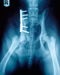 Making Sense Of Hip Dysplasia Treatments
