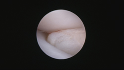 Small Animal Arthroscopy: 30 Years Of Learning