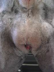 Common Cause Of Chronic UTI Has A Surgical Solution