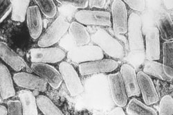Vesicular Stomatitis Confirmed In Texas