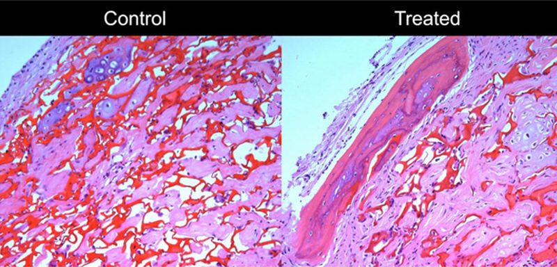 UWM uncovers bone-replacement proteins