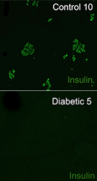 Study: Researchers Highlight Underlying Cause of Diabetes in Dogs