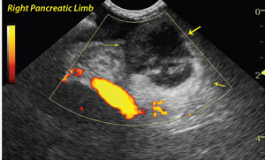 Make Sound Commitment To Sonography