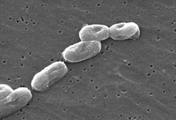 UGA Receives $1.1 Million To Develop Vaccine Against Biological Agents