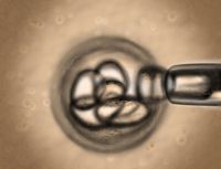 Cellular Care Begins With Autophagy
