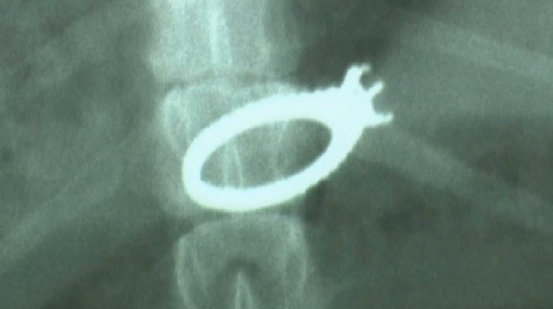 Veterinarians Remove Diamond Engagement Ring from Dog’s Stomach