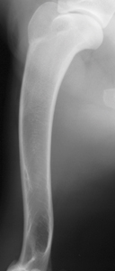 What's Your Diagnosis? Reasons For Lameness