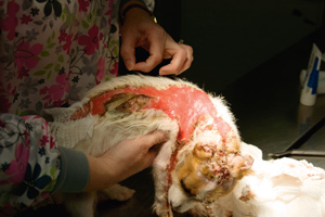 Laser Therapy Helps Heal Victim’s Burns