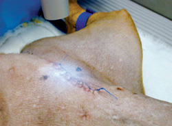 Lasers Financially Therapeutic, Too
