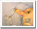 The Dowling Spay Retractor
