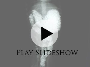 play button