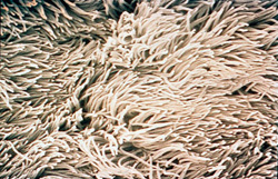 Flu Trachea