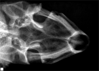 X-Ray