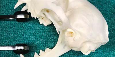 Avoid the dangers of spring-loaded mouth props