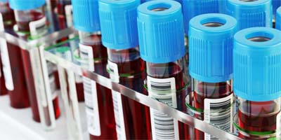 Is a cure for IMHA near?