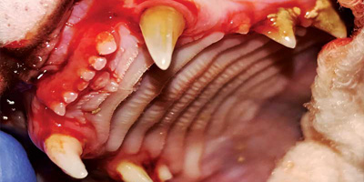 Diabetes and dental disease