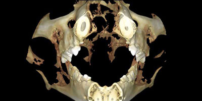 Cone-beam computed tomography in dentistry and oral surgery