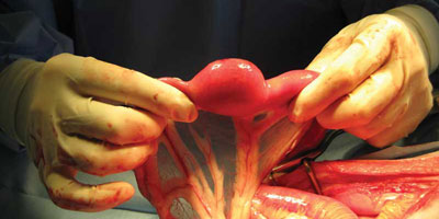 Four bold questions about hand asepsis