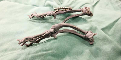 How 3-D printing benefits presurgical planning for angular limb deformity