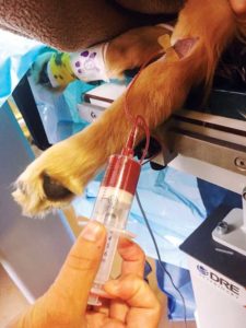 Blood is collected for platelet-rich plasma (PRP) therapy. 