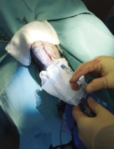 Blood is collected for platelet-rich plasma (PRP) therapy (left). Separating the PRP from the sample. PRP is injected into the patient. Photos courtesy Caledon Mountain Veterinary Hospital
