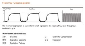 Figures Courtesy Respironics Inc. (2005). Capnography Reference Handbook. Retried from BIT.LY/2X2G8DG.