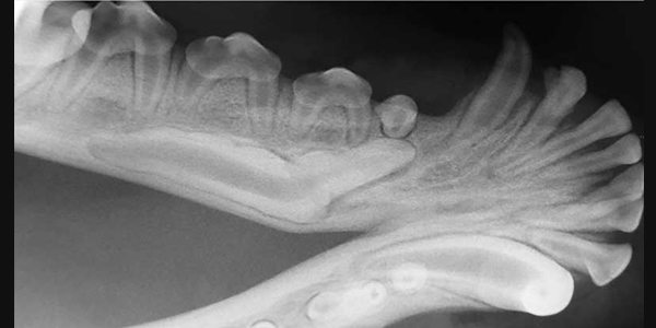 Piezosurgery in dentistry and oral surgery